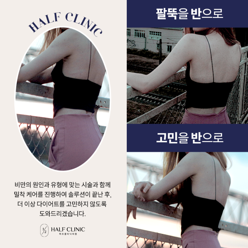 팔뚝지방분해주사 부작용 걱정없이 팔뚝 다이어트 성공! 2