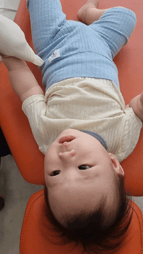 7개월아기 소아치과 첫방문기 - 유아 순소대, 융합치