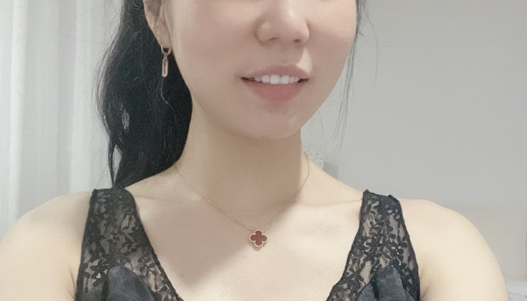  처진 볼살 티타늄 리프팅 효과 티안나게 예뻐지는 시술 ( 통증 , 턱선 리프팅 )