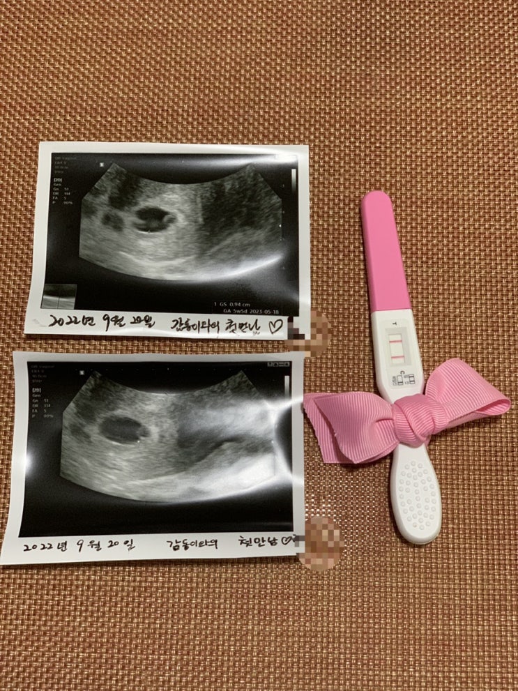  [육아일기] 예비맘 두콩두콩 인사 드립니다 ️