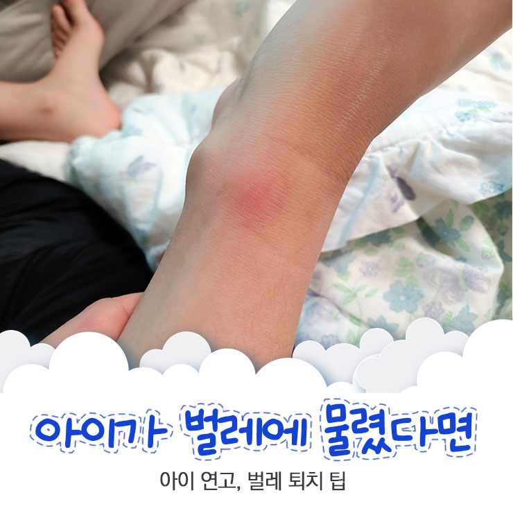  아이가 벌레에 물렸을때 대처방법 벌레 방지 팁 알아봐요