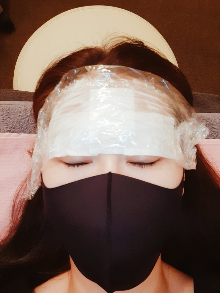  눈꺼풀처짐 고민으로 강남가서 아이업눈꺼풀실리프팅하고 온 후기
