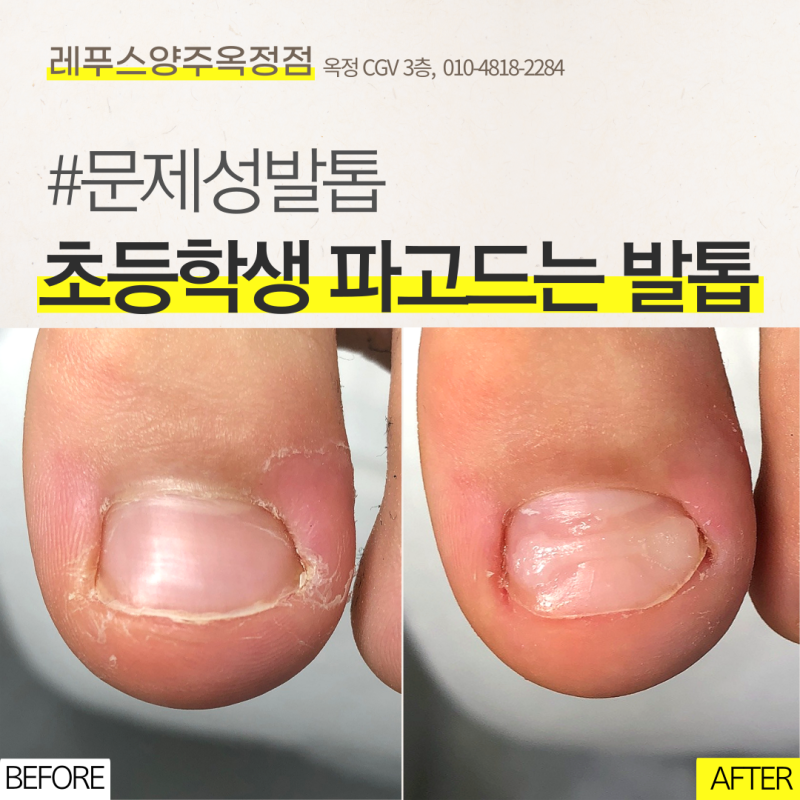 더피 발굽과 딩키 두