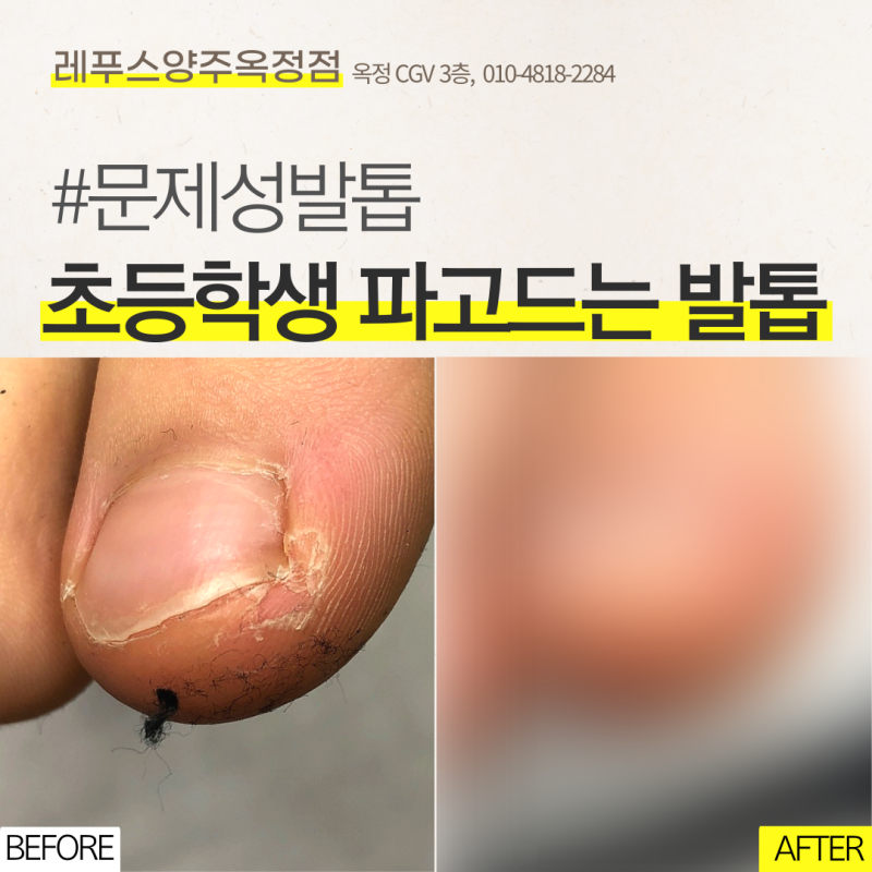 더피 발굽과 딩키 두