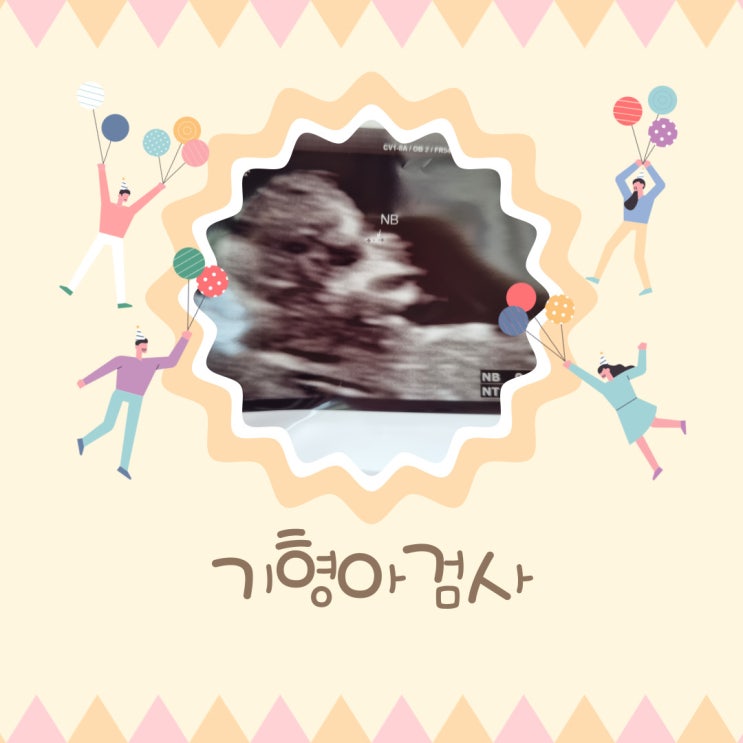  기형아 검사에 대하여...