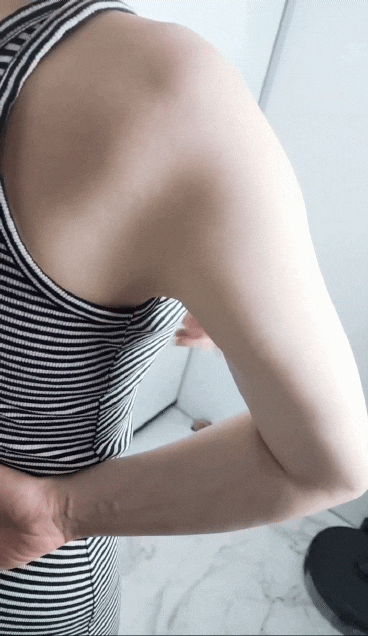  신부관리 다리 붓기 제거 신사역피부과 비만주사 2회차 효과 허벅지살 팔뚝살 빼기 추천 후기