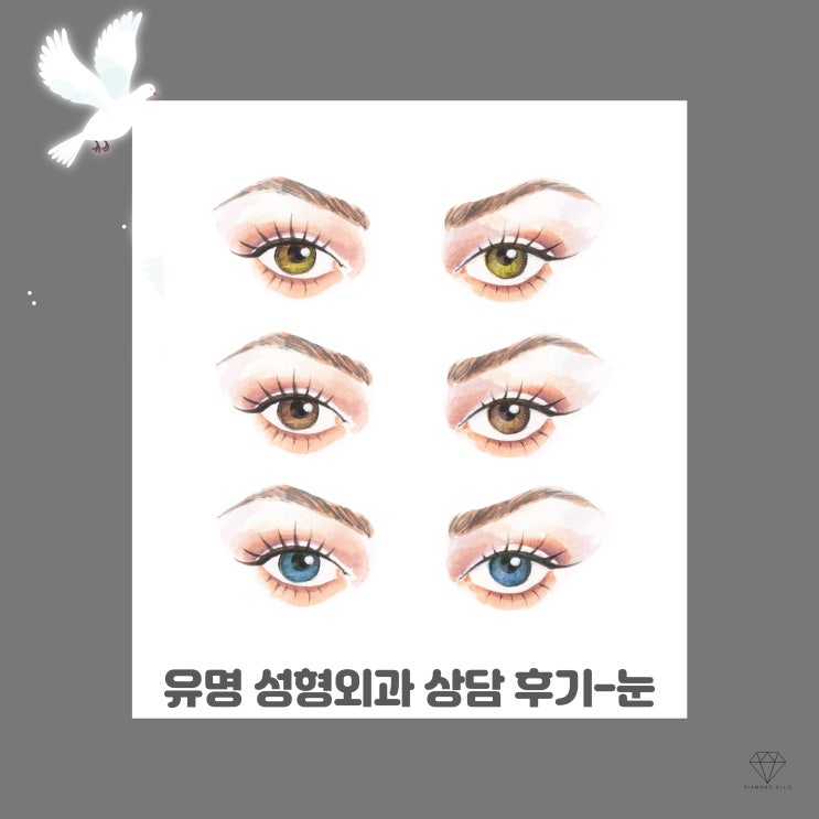  강남 유명 성형외과 5군데 상담 후기 - 눈