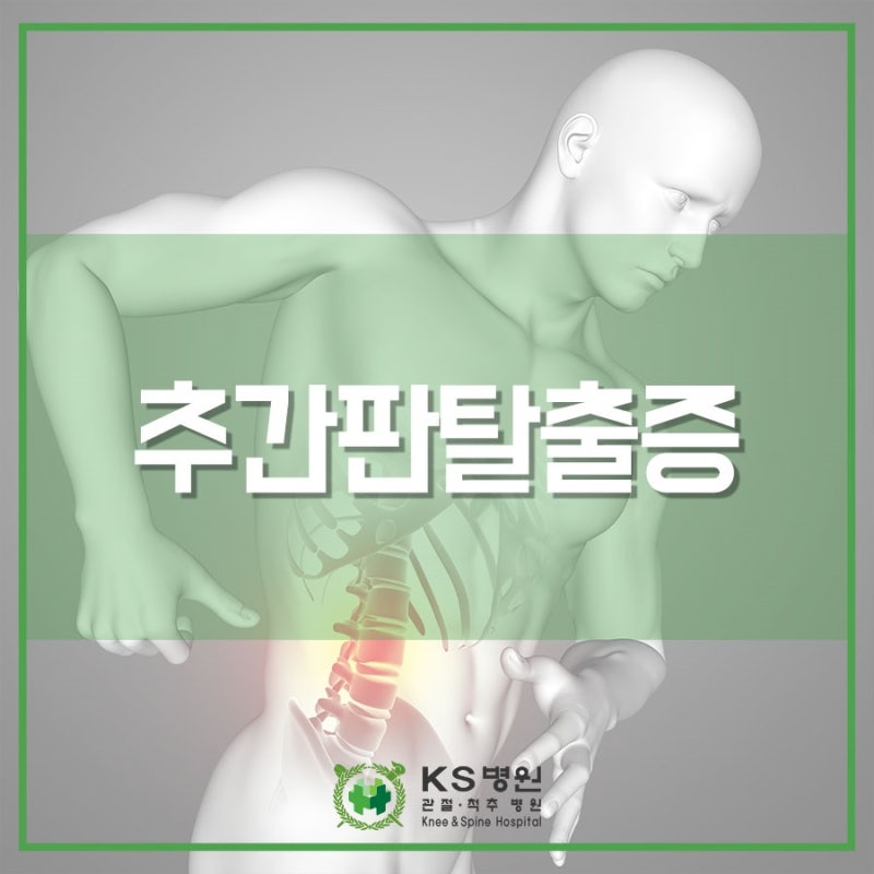 추간판탈출증, 척추병원에서는 허리통증치료 어떻게? 1