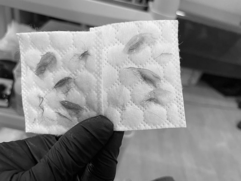 광주피부자격증/ 수완지구 피부관리/광주 웨딩관리/ 광주피부샵창업 /월드뷰티 11