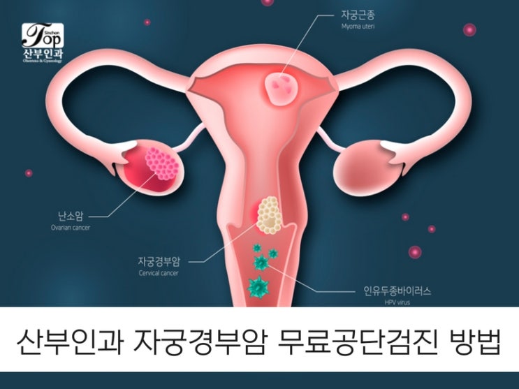 산부인과 자궁경부암 무료공단검진 방법