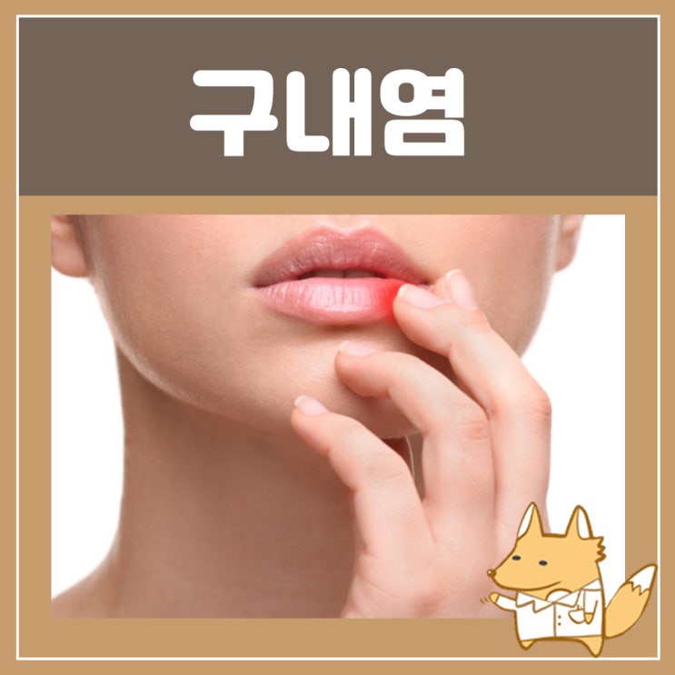  구내염빨리낫는법 오라메디 : 아프타성 잇몸 혓바닥 입천장 목 입안 구내염 전염 연고 약