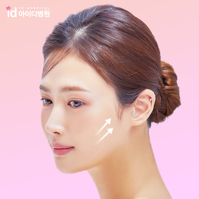 안면거상술 후기 작아진 얼굴로 안면거상술 후기 작아진 얼굴로