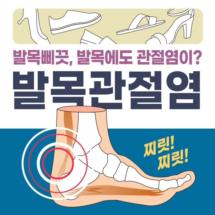  강서구발목병원 발목삐끗 치료 늦으면 관절염으로