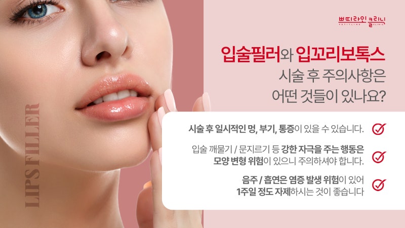 부천피부과 추천 자연스러운 입술 필러 1cc+입가보톡스 리뷰(통증, 멍, 붓기, 부작용 등)