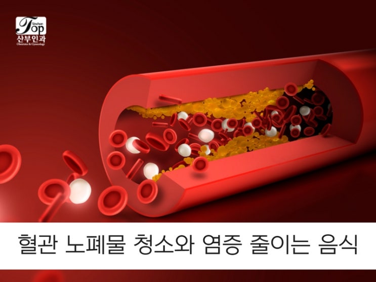 혈관 노폐물 청소와 염증 줄이는 음식 혈관 노폐물 청소와 염증 줄이는 음식