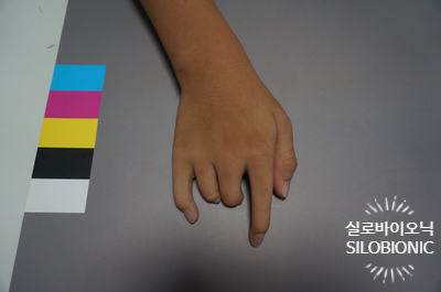  기능적으로 도움을 주는 손 의수(의지)