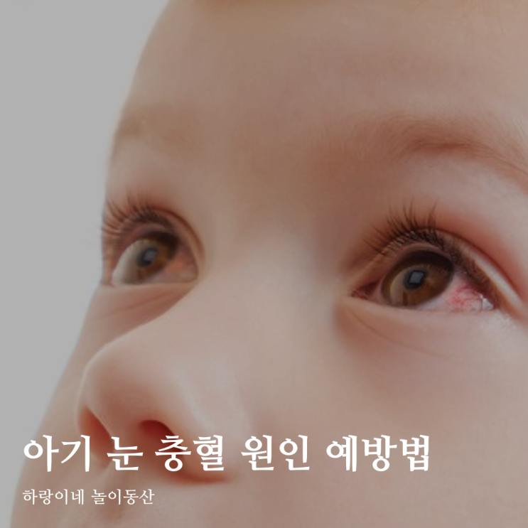 아기 눈 충혈 원인 광주안과 서포터즈가 알려드림