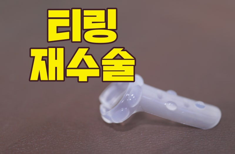 성기자가 지방이식해서 틸링수술할 수 있나요?