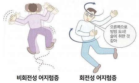 어지럼증 유발 귀질환(전정신경염, 메니에르병, 이석증)의 원인, 증상, 한의원 치료 / 메스꺼움, 귀먹먹, 난청 6