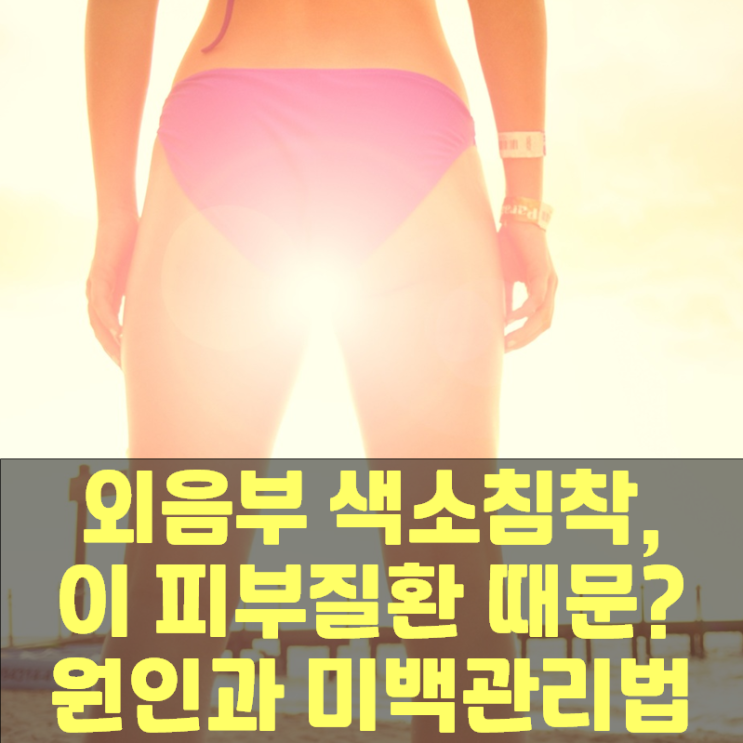  외음부 색소침착, 이 피부질환 때문? 원인과 미백관리법