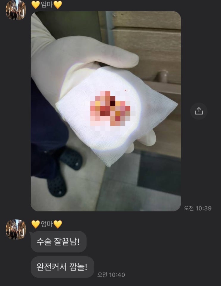 광주 편도수술 후기 : 1일~3일차 (입원-퇴원)