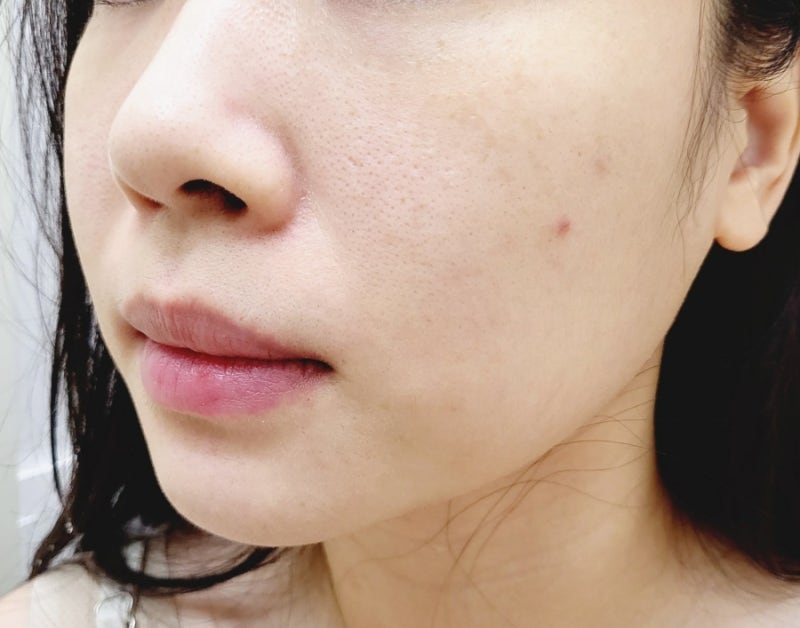 젊은 미학은 좋은 가족 피부 관리입니다