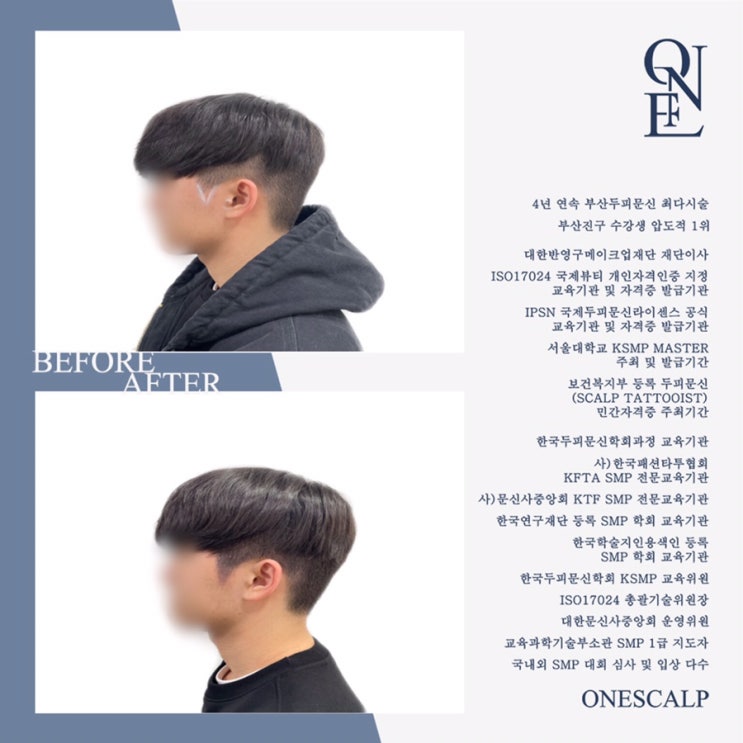  부산구렛나루두피문신 SMP전문 교육기관 원스칼프에서!