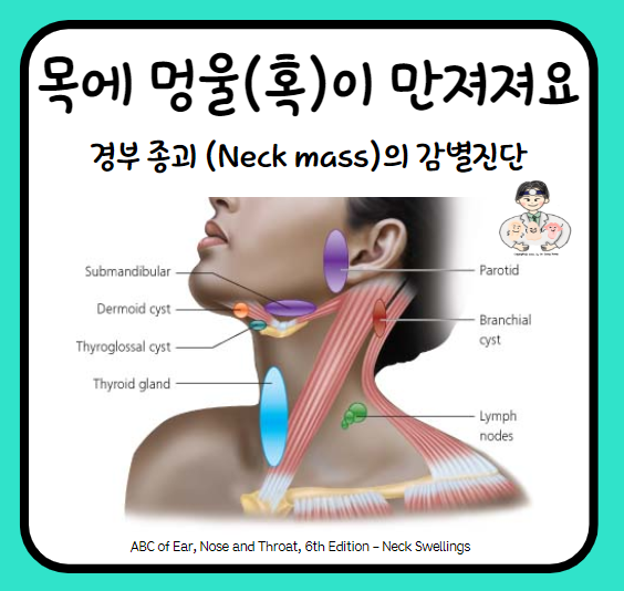  목에서 멍울이 만져져요 (1) - 경부 종괴(Neck mass)의 감별진단
