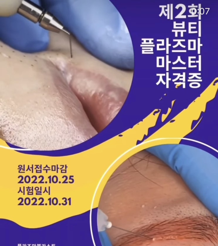  [대구 아미뷰티 아카데미] 제2회 뷰티플라즈마 자격증시험_1:1개인수강 / ( 플라즈마블라스트.콜드플라즈마 남대구지사)
