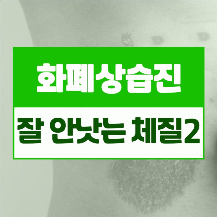  화폐상습진 잘 안 낫는 체질2 - 식단에 따라 증상이 심해진다면