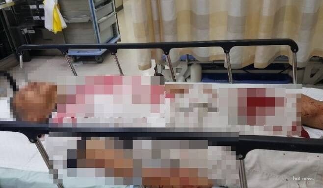 신도림 전동 킥보드 뺑소니범  50대 남성 검거 피해자 아버지 하반신 마비 우려