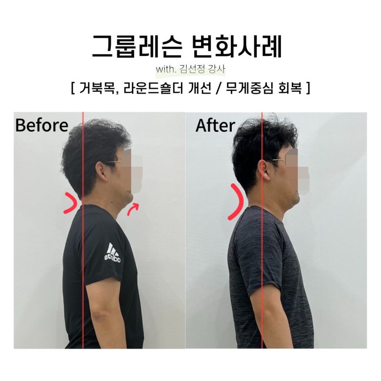  [대구SNPE] 남성회원님의 통증도 잡고 몸도 리셋하신 후기