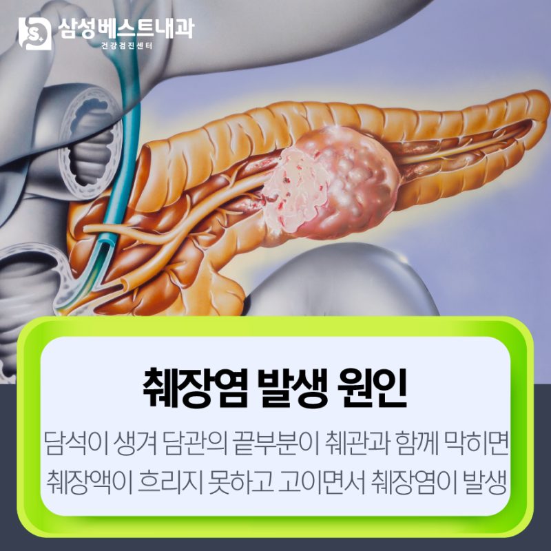 췌장염 만성화되면 췌장암으로? 췌장염 원인과 증상 : 네이버 블로그
