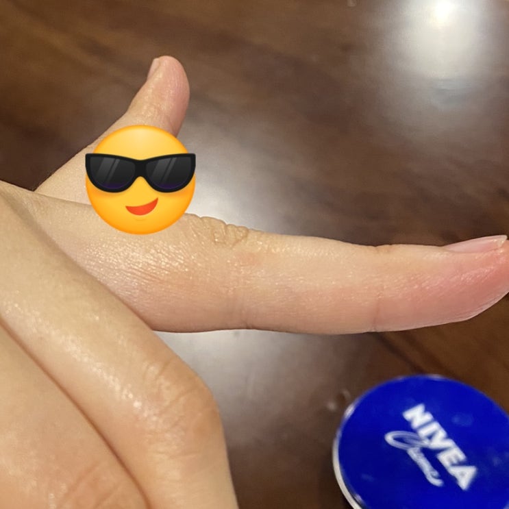  한포진 내돈내산 치료후기::도봉구 피부과 추천, 가격, 한포진 완쾌 여부, 한달 경과후기 [연세늘봄피부과]