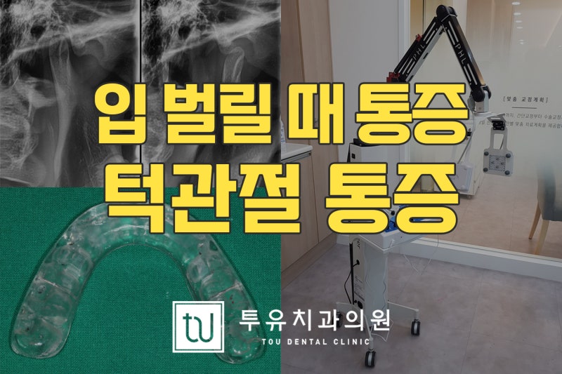 송도턱관절병원 턱이 아픈 이유 2