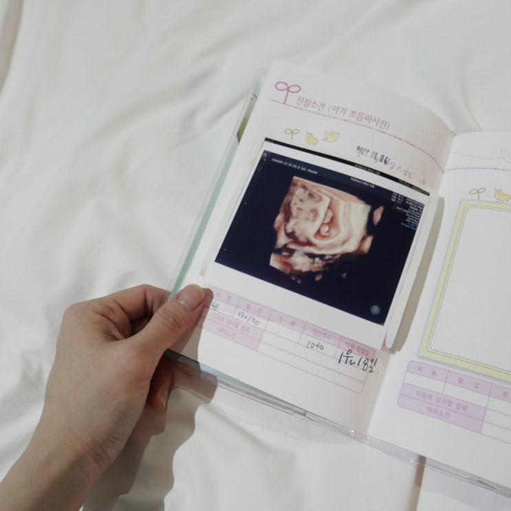  임신 9주차 10주차 초음파와 증상 + 다리사이에 저거..아니죠?