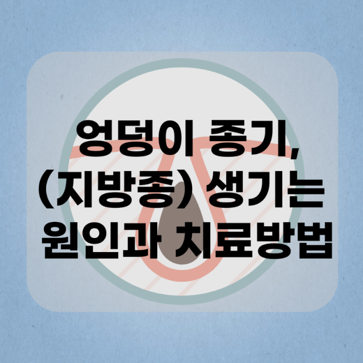  엉덩이 종기,지방종 생기는 원인과 예방,치료방법