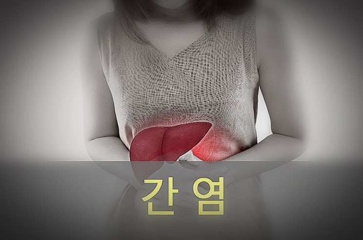  A형, B형, C형, 간염 원인과 증상, 예방, 좋은 음식