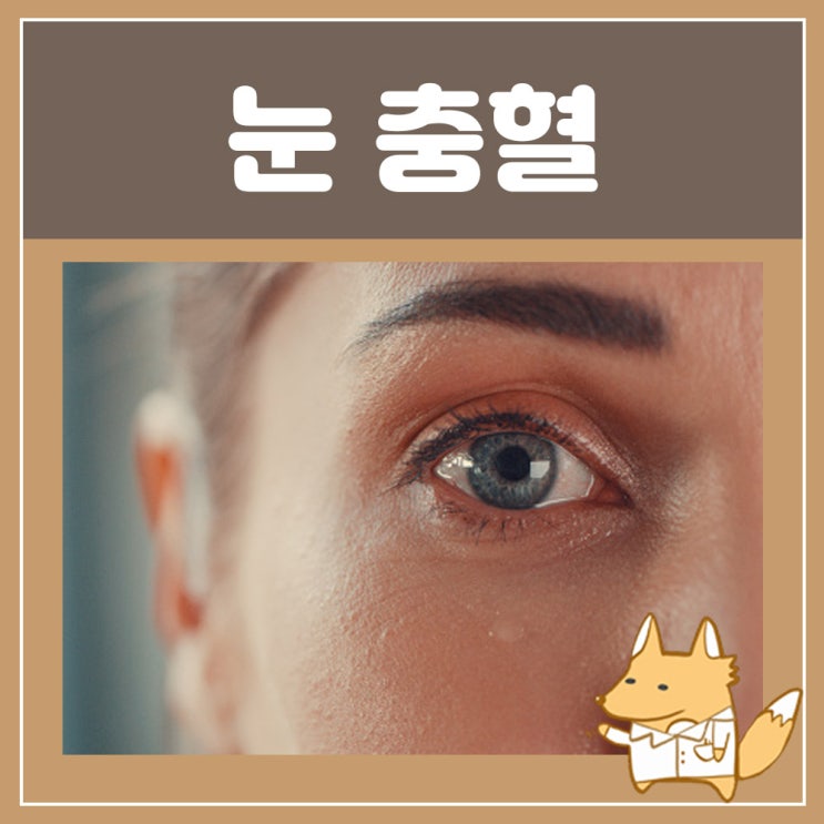 눈 실핏줄 터짐 결막하출혈 : 한쪽 눈 충혈 원인, 눈 따가움 간지러움, 왼쪽 오른쪽 눈 통증