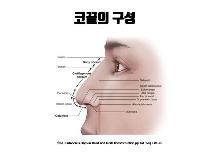  코끝성형으로 코끝을 높일 때는 반드시 코소엽과 비주를 같이 높여야 해요!!!