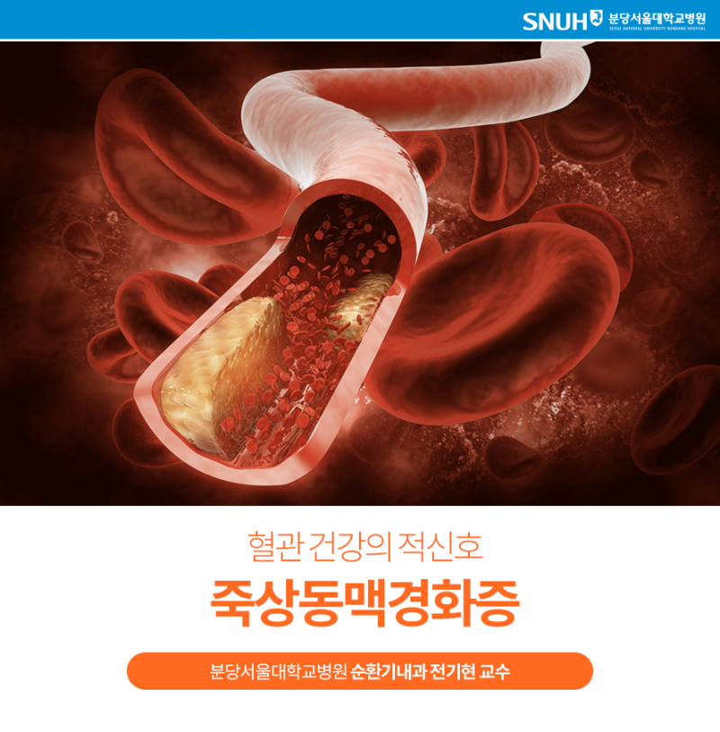 부산 고지혈증, 혈관막는 동맥경화증 발생 가속