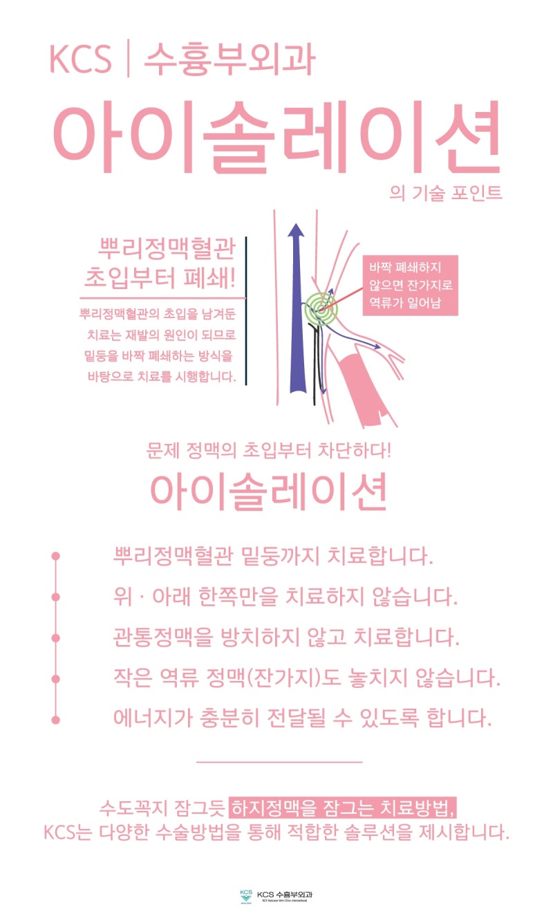대구 하지정맥수술 작은 부분까지 놓치지않고
