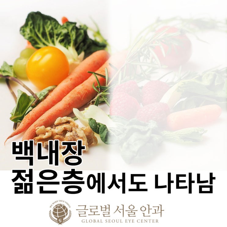 강남안과 백내장, 젊은층에서도 나타남