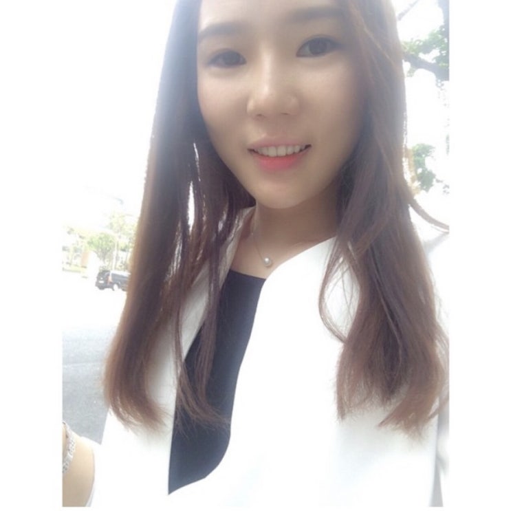  청담 피부과 쳐진 볼살 리프팅 효과 본 튠페이스 재시술 후기 ( + 비용 가격 )