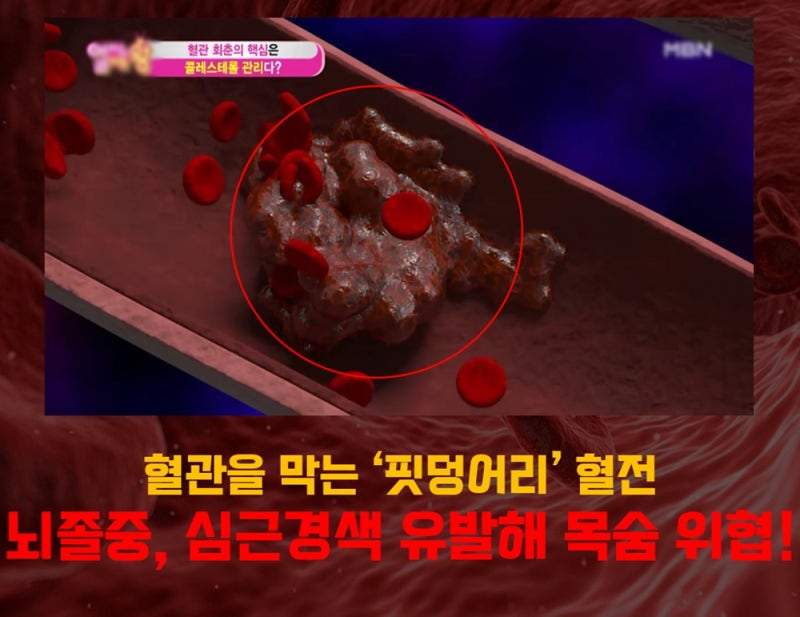 혈전용해제 역할 및 혈전 예방의 모든 것 : 네이버 블로그