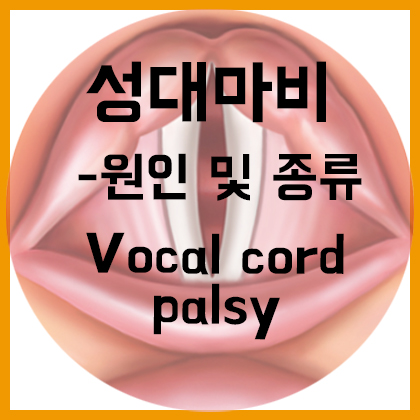  [목] 성대마비(Vocal cord palsy)-원인 및 종류