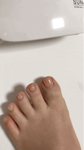  내성발톱 토메드 파고드는 발톱을 위한 케어솔루션
