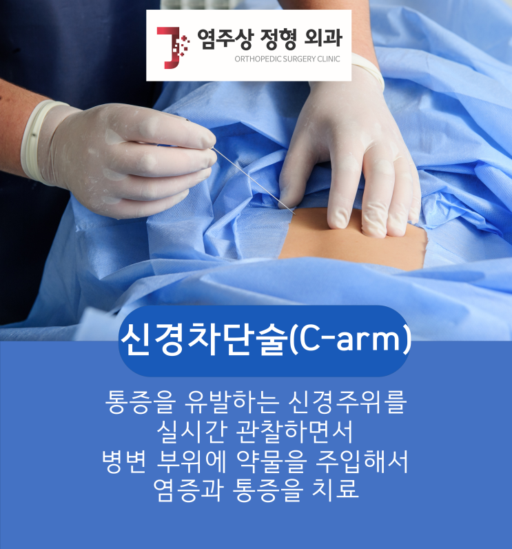  발산역정형외과 신경차단술로 허리통증치료