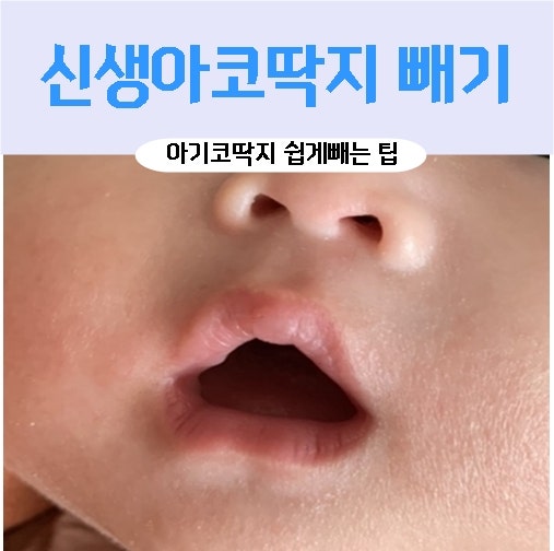 아기 콧물 치우는 방법 / 주의사항 / 생리식염수, 면봉 / 신생아 콧물 치우기 아기 콧물 치우는 방법 / 주의사항 / 생리식염수, 면봉 / 신생아 콧물 치우기