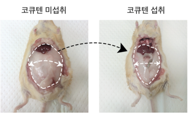  콜레스테롤 약 없이 고지혈증 치료하는 법 <질병퇴치본부>
